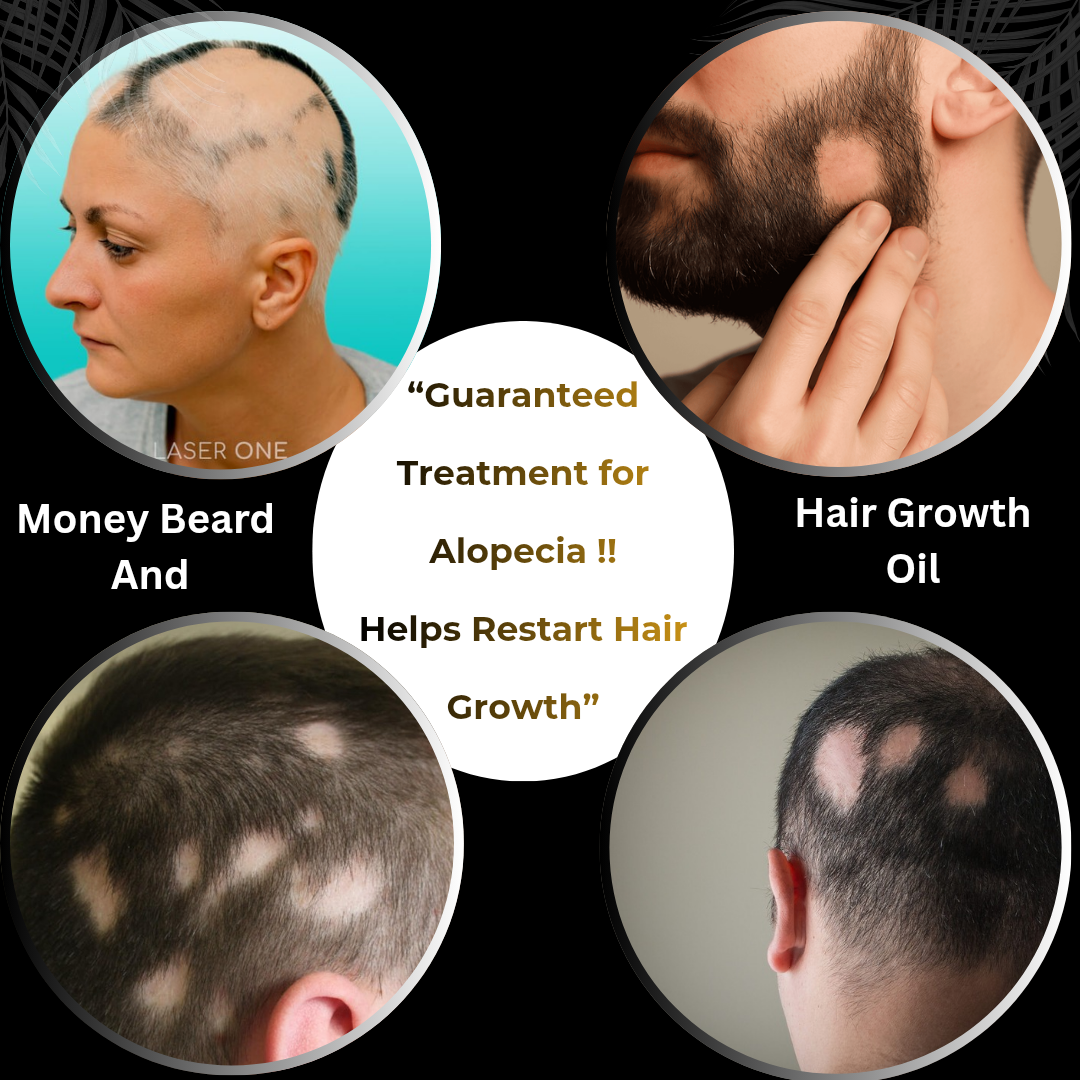 Ayurvedic Alopecia Kit - Image 2